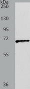 Solute carrier family 22 member 3 antibody, TA322214, Origene, Western Blot image 