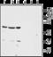 Neurotensin Receptor 1 antibody, GTX02541, GeneTex, Western Blot image 