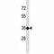 Testis Specific Protein Y-Linked 3 antibody, F40043-0.4ML, NSJ Bioreagents, Western Blot image 