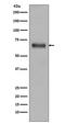 Transforming Growth Factor Beta Induced antibody, M01218-2, Boster Biological Technology, Western Blot image 