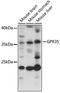 G Protein-Coupled Receptor 35 antibody, 18-168, ProSci, Western Blot image 