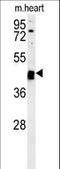 Tubulointerstitial Nephritis Antigen Like 1 antibody, LS-C161894, Lifespan Biosciences, Western Blot image 