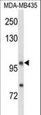 Neuropilin 1 antibody, LS-C163016, Lifespan Biosciences, Western Blot image 