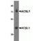 Acyl-CoA Synthetase Long Chain Family Member 1 antibody, TA319649, Origene, Western Blot image 