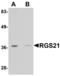 Regulator Of G Protein Signaling 21 antibody, MBS151421, MyBioSource, Western Blot image 