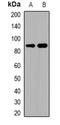 ADAM Metallopeptidase Domain 32 antibody, orb382544, Biorbyt, Western Blot image 