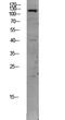 TEK Receptor Tyrosine Kinase antibody, STJ99610, St John