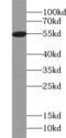 GC Vitamin D Binding Protein antibody, FNab09413, FineTest, Western Blot image 