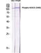 Histone Deacetylase 5 antibody, A01230S498, Boster Biological Technology, Western Blot image 