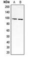 Chloride Voltage-Gated Channel 6 antibody, MBS821098, MyBioSource, Western Blot image 