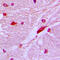 Homeobox protein cut-like 1 antibody, GTX56275, GeneTex, Immunohistochemistry paraffin image 