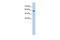 Transmembrane Protein 8B antibody, GTX47016, GeneTex, Western Blot image 