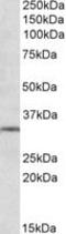 Glutamate Metabotropic Receptor 2 antibody, MBS422481, MyBioSource, Western Blot image 