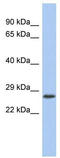 VENT Homeobox antibody, TA339468, Origene, Western Blot image 