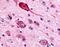 Gamma-Aminobutyric Acid Type B Receptor Subunit 1 antibody, NLS5332, Novus Biologicals, Immunohistochemistry paraffin image 