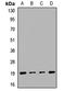 Protein Phosphatase 3 Regulatory Subunit B, Alpha antibody, LS-C667722, Lifespan Biosciences, Western Blot image 