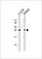 Thymidine Kinase 1 antibody, M04850-1, Boster Biological Technology, Western Blot image 
