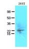 Ubiquitin Conjugating Enzyme E2 S antibody, NBP1-41126, Novus Biologicals, Western Blot image 