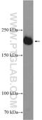 Kinase Insert Domain Receptor antibody, 26415-1-AP, Proteintech Group, Western Blot image 