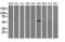 TACO antibody, NBP2-02779, Novus Biologicals, Western Blot image 