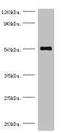 Trimethyllysine Hydroxylase, Epsilon antibody, A54914-100, Epigentek, Western Blot image 