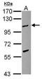 TPX2 Microtubule Nucleation Factor antibody, PA5-30455, Invitrogen Antibodies, Western Blot image 