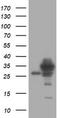 SRP Receptor Subunit Beta antibody, TA504723, Origene, Western Blot image 