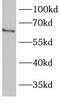 Bardet-Biedl Syndrome 1 antibody, FNab00813, FineTest, Western Blot image 