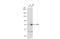 5'-Nucleotidase Ecto antibody, GTX113509, GeneTex, Western Blot image 