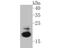 Follicle Stimulating Hormone Subunit Beta antibody, NBP2-80459, Novus Biologicals, Western Blot image 