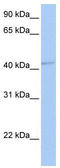 Gamma-Aminobutyric Acid Type A Receptor Alpha5 Subunit antibody, TA338505, Origene, Western Blot image 
