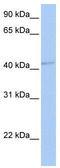 Gamma-Aminobutyric Acid Type A Receptor Alpha5 Subunit antibody, TA338505, Origene, Western Blot image 