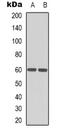 Hexosaminidase Subunit Alpha antibody, orb339122, Biorbyt, Western Blot image 
