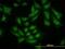 SMAD Specific E3 Ubiquitin Protein Ligase 1 antibody, ab117552, Abcam, Immunofluorescence image 