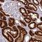 Trafficking Protein Particle Complex 1 antibody, HPA052398, Atlas Antibodies, Immunohistochemistry paraffin image 