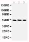 Checkpoint Kinase 1 antibody, PA1445, Boster Biological Technology, Western Blot image 