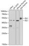 ISL LIM Homeobox 1 antibody, A02969, Boster Biological Technology, Western Blot image 