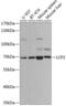 Lymphocyte Cytosolic Protein 2 antibody, GTX54341, GeneTex, Western Blot image 