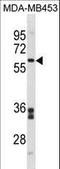 Flavin Containing Dimethylaniline Monoxygenase 5 antibody, LS-C157752, Lifespan Biosciences, Western Blot image 