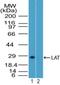 Origin Recognition Complex Subunit 3 antibody, PA5-73011, Invitrogen Antibodies, Western Blot image 