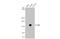 AXL Receptor Tyrosine Kinase antibody, GTX129407, GeneTex, Western Blot image 