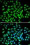 Methyl-CpG Binding Protein 2 antibody, LS-C748379, Lifespan Biosciences, Immunofluorescence image 