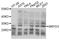 SET And MYND Domain Containing 3 antibody, STJ25631, St John