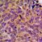 Tousled Like Kinase 1 antibody, orb214939, Biorbyt, Immunohistochemistry paraffin image 