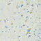 Solute Carrier Family 1 Member 4 antibody, 14-469, ProSci, Immunohistochemistry frozen image 