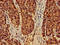 EF-Hand Domain Family Member D2 antibody, LS-C677770, Lifespan Biosciences, Immunohistochemistry paraffin image 