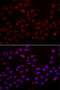 Cystatin SA antibody, 22-322, ProSci, Immunofluorescence image 