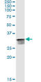 Cyclin Dependent Kinase 2 antibody, LS-C196879, Lifespan Biosciences, Immunoprecipitation image 
