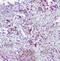 Caspase 2 antibody, A02384-1, Boster Biological Technology, Immunohistochemistry paraffin image 