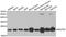 NADH:Ubiquinone Oxidoreductase Subunit S4 antibody, A03608, Boster Biological Technology, Western Blot image 
